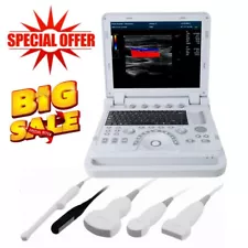 Portable Ultrasound Scanner Color Doppler Diagnostic System ultrasonido doppler