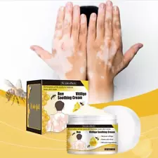 1x 30g BeeVenom Vitiligo Care Cream For All Skin Types Sale