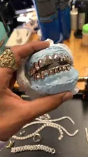 gold grillz