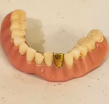 Dental Gold Cap In False Teeth Disgusting Look